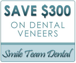 Save $300 On Dental Veneers