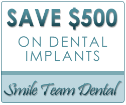 Save $500 On Dental Implants